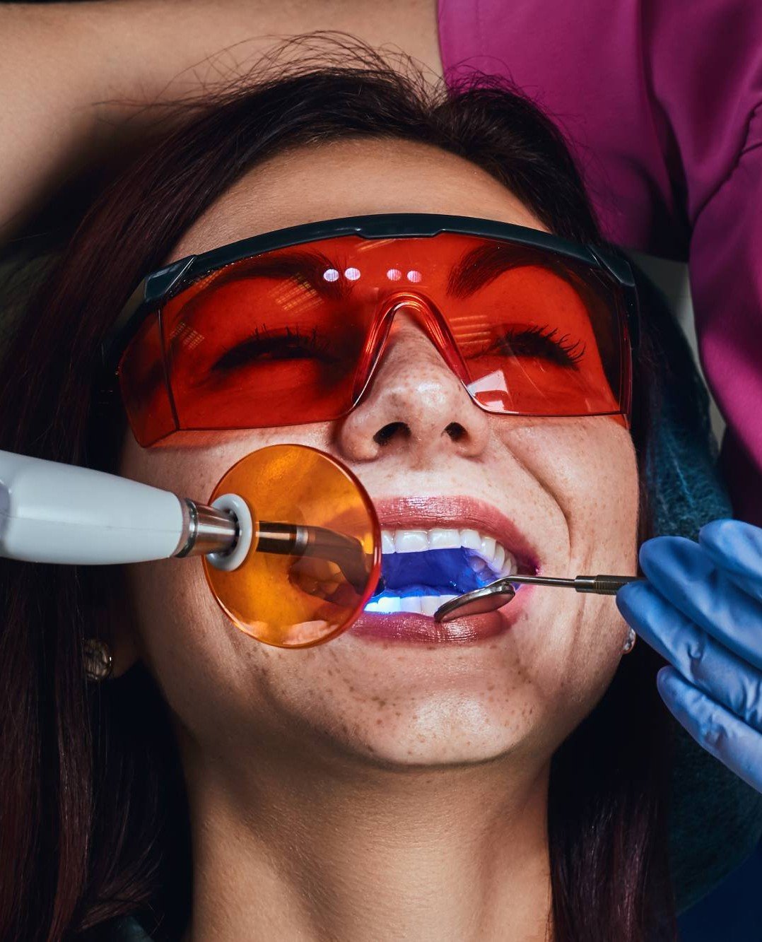 dentista Asa Norte, Brasília - DF prótese dentária