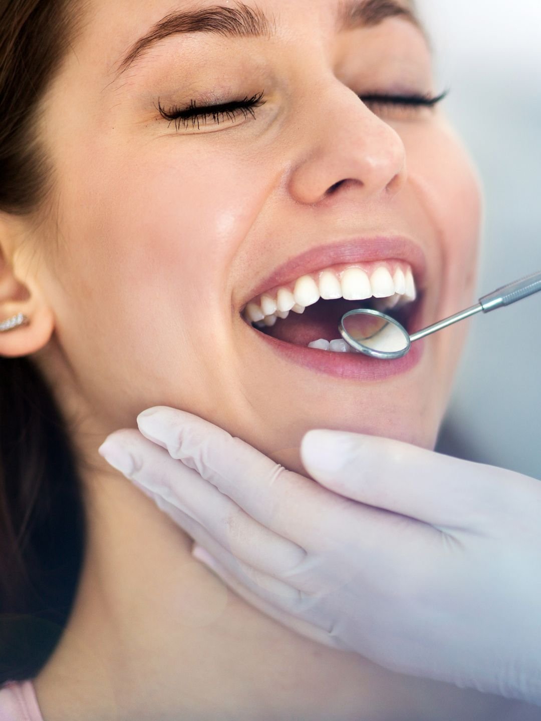 O Invisalign é um conjunto de placas transparentes que encaixam perfeitamente nos dentes.